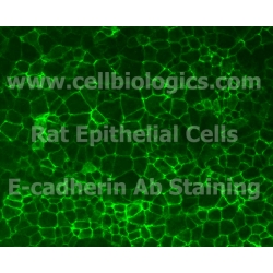 BKS db Control Mouse Bladder Epithelial Cells